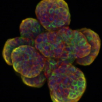 Radiobiology of stem cells (cancer and normal